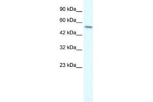 RGS6 antibody used at 2 ug/ml to detect target protein. (RGS6 Antikörper  (C-Term))