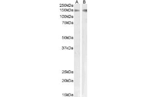 Western Blotting (WB) image for anti-phospholipase A2 Receptor 1, 180kDa (PLA2R1) antibody (ABIN5932307)
