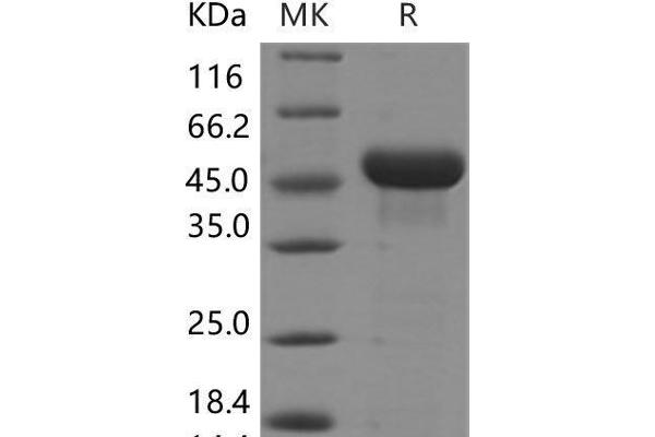 RCN3 Protein (His tag)