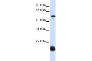SLC22A7 antibody used at 1 ug/ml to detect target protein. (SLC22A7 Antikörper)