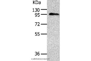 Western blot analysis of Human liver cancer tissue, using AKAP8 Polyclonal Antibody at dilution of 1:500 (AKAP8 Antikörper)