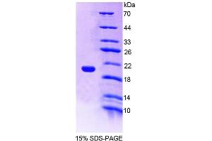 Image no. 1 for Neuropilin 1 (NRP1) (AA 646-814) protein (His tag) (ABIN1080363)