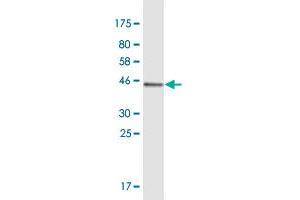 Western Blot detection against Immunogen (40. (Msx2/Hox8 Antikörper  (AA 1-133))