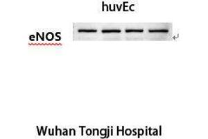 Western Blot (WB) analysis: Please contact us for more details. (ENOS Antikörper)