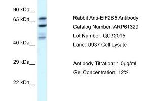 Western Blotting (WB) image for anti-Eukaryotic Translation Initiation Factor 2B, Subunit 5 Epsilon, 82kDa (EIF2B5) (N-Term) antibody (ABIN2788769)