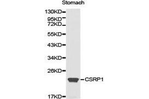 Western Blotting (WB) image for anti-Cysteine and Glycine-Rich Protein 1 (CSRP1) antibody (ABIN1872045) (CSRP1 Antikörper)