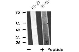 Western blot analysis of extracts from HT-29 cells, using VANGL1 antibody.