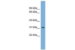 PPM1M antibody used at 1 ug/ml to detect target protein. (PPM1M Antikörper  (Middle Region))