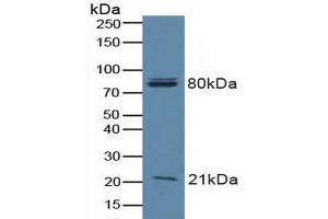 Detection of BAD in Human A549 Cells using Polyclonal Antibody to Bcl2 Associated Death Promoter (BAD) (BAD Antikörper  (AA 1-168))