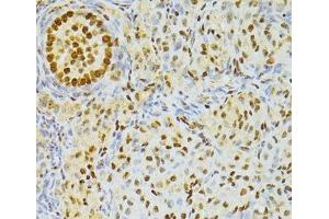 Immunohistochemistry of paraffin-embedded Rat ovary using ALYREF Polyclonal Antibody at dilution of 1:100 (40x lens). (THO Complex 4 Antikörper)