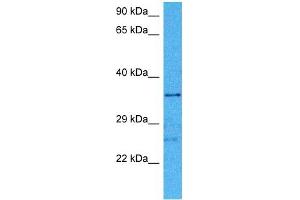 Host:  Mouse  Target Name:  HIF1AN  Sample Tissue:  Mouse Brain  Antibody Dilution:  1ug/ml (HIF1AN Antikörper  (Middle Region))