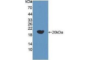 Detection of Recombinant bACE2, Human using Polyclonal Antibody to Beta Secretase 2 (BACE2) (BACE2 Antikörper  (AA 230-396))