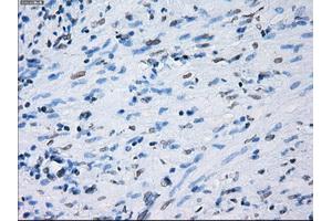 Immunohistochemical staining of paraffin-embedded Ovary tissue using anti-PSMA7mouse monoclonal antibody. (PSMA7 Antikörper)