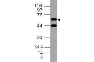 Image no. 1 for anti-SWAP Switching B-Cell Complex 70kDa Subunit (SWAP70) (AA 1-203) antibody (ABIN5027553) (SWAP70 Antikörper  (AA 1-203))