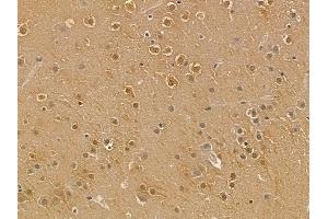 MYCL Mouse Monoclonal Antibody at 1/100 staining mouse brain tissue by IHC-P.