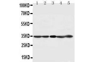 Anti-CDK1 antibody, Western blotting Lane 1: HELA Cell Lysate Lane 2: 293T Cell Lysate Lane 3: A431 Cell Lysate Lane 4: CEM Cell Lysate Lane 5: JURKAT Cell Lysate (CDK1 Antikörper  (C-Term))