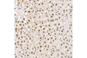 Immunohistochemistry of paraffin-embedded rat liver using Phospho-Smad2-S465/467 + Smad3-S423/425 Rabbit pAb (ABIN6135314, ABIN6136248, ABIN6136249 and ABIN6225575) at dilution of 1:50 (40x lens). (SMAD2 / SMAD3 (pSer423), (pSer425) Antikörper)