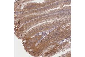 Immunohistochemical staining of human stomach with TMEM39A polyclonal antibody  shows moderate cytoplasmic positivity in glandular cells at 1:10-1:20 dilution. (TMEM39A Antikörper)