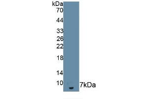 Detection of Recombinant IL18R1, Human using Monoclonal Antibody to Interleukin 18 Receptor 1 (IL18R1) (IL18R1 Antikörper  (AA 375-428))