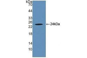 Detection of Recombinant CRYaB, Human using Polyclonal Antibody to Crystallin Alpha B (CRYaB) (CRYAB Antikörper  (AA 1-175))
