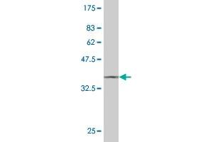 Western Blot detection against Immunogen (37. (STYK1 Antikörper  (AA 50-159))