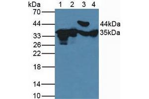 Figure. (FN3K Antikörper  (AA 1-309))