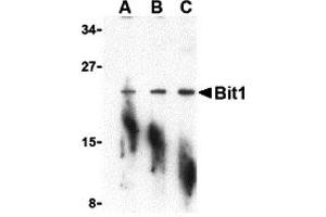 Western Blotting (WB) image for anti-Peptidyl-tRNA Hydrolase 2 (PTRH2) (N-Term) antibody (ABIN1031275) (PTRH2 Antikörper  (N-Term))