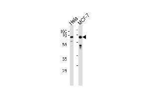 FOXO3 Antibody (N-term) (ABIN657229 and ABIN2846331) western blot analysis in Hela,MCF-7 cell line lysates (35 μg/lane). (FOXO3 Antikörper  (N-Term))
