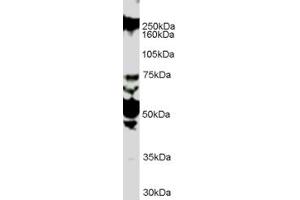 Western Blotting (WB) image for anti-Roundabout, Axon Guidance Receptor, Homolog 1 (ROBO1) (Internal Region) antibody (ABIN2466219) (ROBO1 Antikörper  (Internal Region))