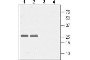 Western blot analysis of rat (lanes 1 and 3) and mouse (lanes 2 and 4) brain lysates: - 1,2. (CACNG5 Antikörper  (1st Extracellular Loop))
