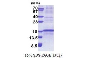 SDS-PAGE (SDS) image for Ribosomal Protein L34 (RPL34) (AA 1-117) protein (His tag) (ABIN5853251)