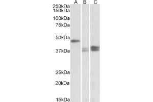 AP23763PU-N TXNDC5 antibody staining of Mouse Lymph Nodes (A), Stomach (B) and Intestine (C) lysates at 0. (TXNDC5 Antikörper  (Internal Region))