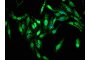 Immunofluorescence staining of Hela cells with ABIN7169262 at 1:333, counter-stained with DAPI. (PPP2R4 Antikörper  (AA 1-250))