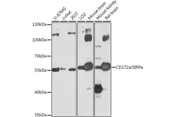 SIRPA antibody  (AA 395-504)