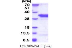SDS-PAGE (SDS) image for TSR2, 20S rRNA Accumulation, Homolog (TSR2) (AA 1-190) protein (His tag) (ABIN6387481)