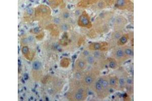 Used in DAB staining on fromalin fixed paraffin-embedded Liver tissue (LTA Antikörper  (AA 36-205))