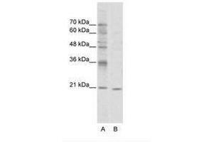 Image no. 1 for anti-Visual System Homeobox 1 (VSX1) (N-Term) antibody (ABIN202105) (VSX1 Antikörper  (N-Term))