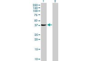 Lane 1: SUGT1 transfected lysate ( 37.