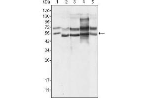 Western Blot showing using GABPA antibody used against Hela (1), A549 (2), MCF-7 (3), NIH/3T3 (4) and SMMC-7721 (5) cell lysate. (GABPA Antikörper  (AA 120-190))