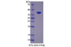 Image no. 1 for Flightless I Homolog (FLII) (AA 896-1176) protein (His tag) (ABIN6237279) (FLII Protein (AA 896-1176) (His tag))