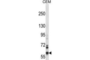 Western Blotting (WB) image for anti-NADPH Oxidase 5 (NOX5) antibody (ABIN2997647)