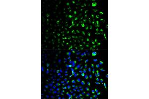 Immunofluorescence analysis of U2OS cells using HK1 antibody (ABIN5970413). (Hexokinase 1 Antikörper)