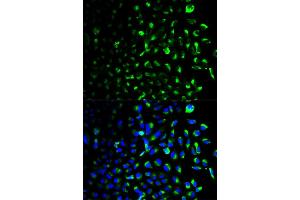 Immunofluorescence analysis of U2OS cells using HK1 antibody (ABIN5970413). (Hexokinase 1 Antikörper)