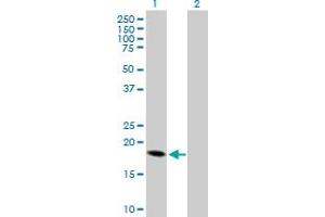Western Blot analysis of CRH expression in transfected 293T cell line by CRH MaxPab polyclonal antibody. (CRH Antikörper  (AA 1-196))