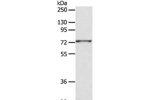 Western Blot analysis of PC3 cell using CD156c Polyclonal Antibody at dilution of 1:300 (ADAM10 Antikörper)