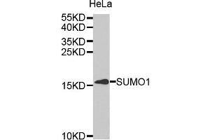 Western blot analysis of extracts of HeLa cell line, using SUMO1 antibody.