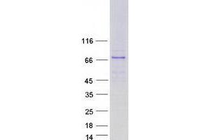 Validation with Western Blot