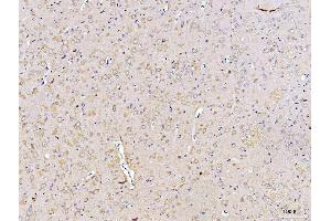 IHC analysis of DUSP6 using anti-DUSP6 antibody (ABIN7599332).