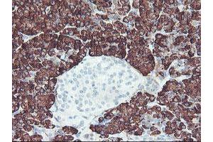Image no. 4 for anti-Carboxypeptidase A2 (Pancreatic) (CPA2) antibody (ABIN1497594) (Carboxypeptidase A2 Antikörper)