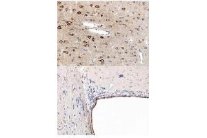Immunohistochemistry (IHC) image for anti-Peroxisome Proliferator-Activated Receptor alpha (PPARA) (N-Term) antibody (ABIN1043876)